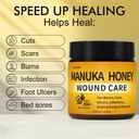 manuka-honey-for-wounds-speed-up-healing-3.jpg