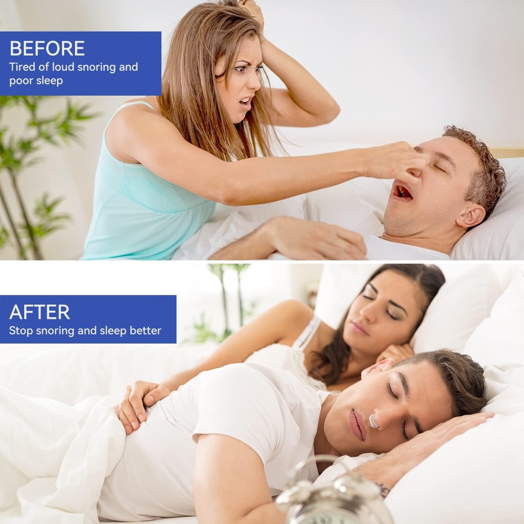 anti-snoring-devices-anskysea-snoring-so-2.jpg