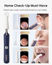 bebird-earsight-plus-d39r-ear-wax-remova-6.jpg