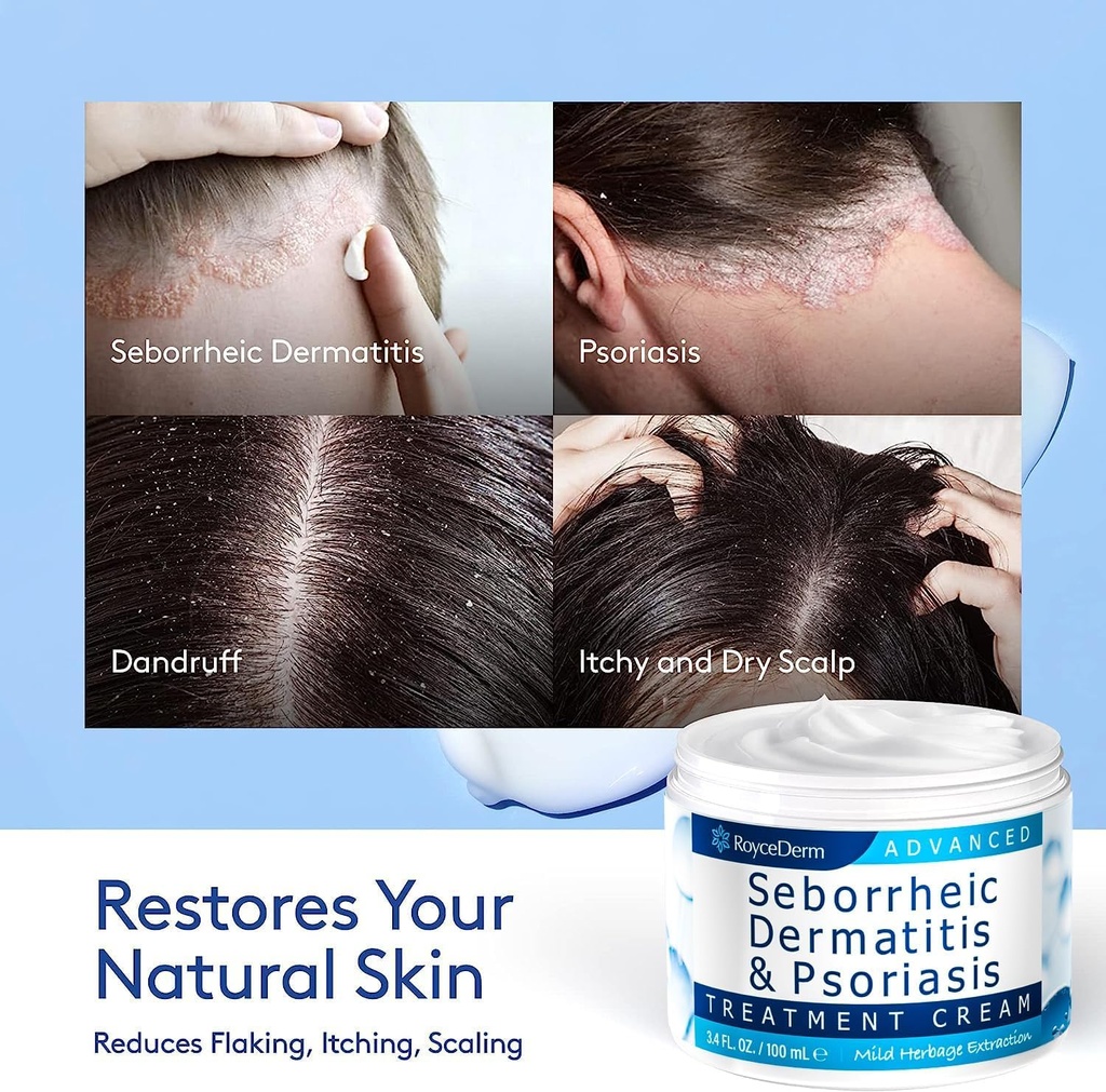 roycederm-seborrheic-dermatitis-psoriasi-5.jpg