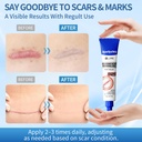 drmitsui-silicone-scar-gel-for-old-and-n-71+QxNguStL.jpg