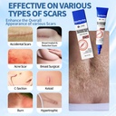 drmitsui-silicone-scar-gel-for-old-and-n-71jFqge8N5L.jpg