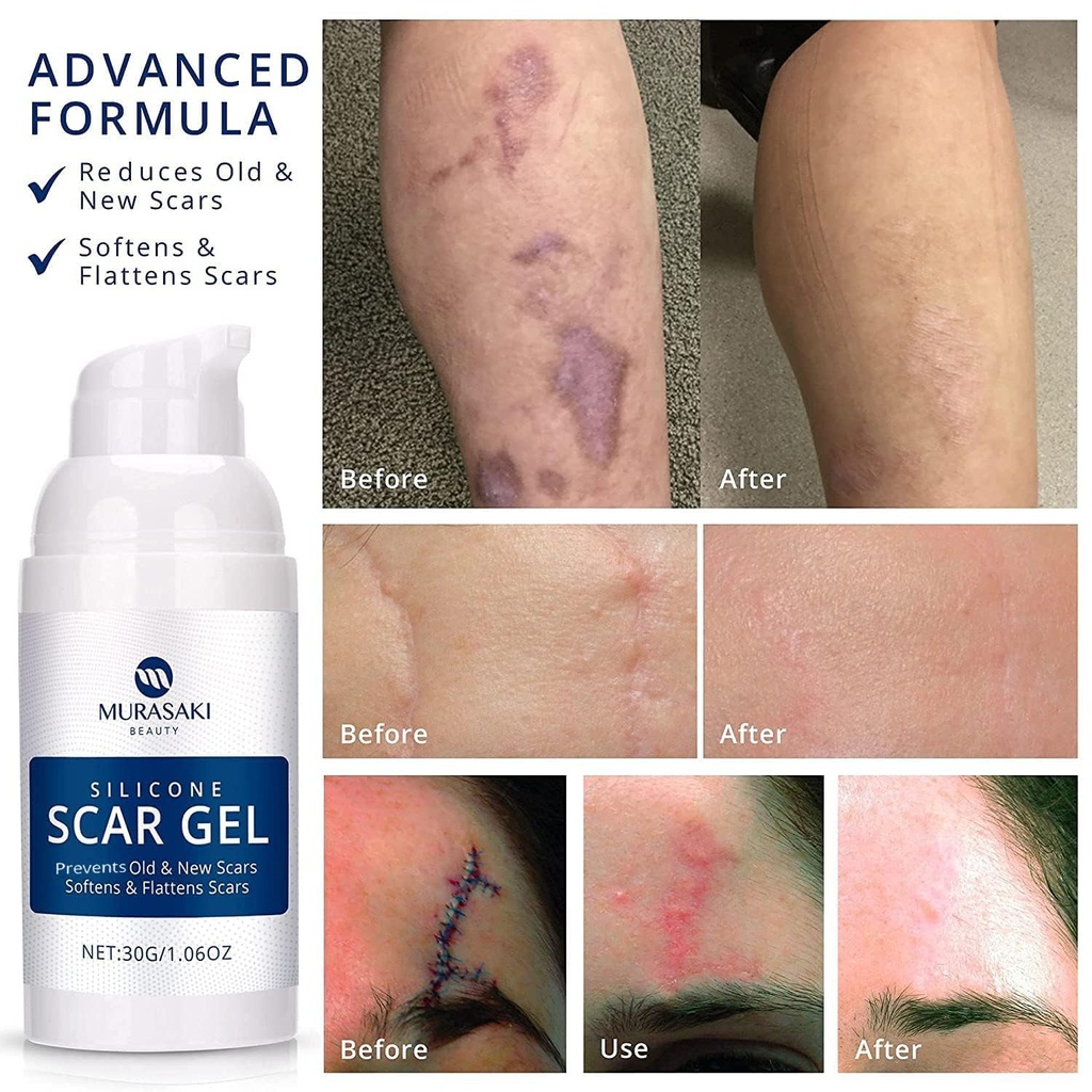 100-silicone-scar-gel-2-pack-2-x-1-06oz--71+EmVpixeL.jpg