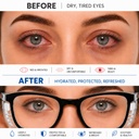 moisture-chamber-glasses-for-dry-eyes-tr-71OyDVP4ZTL.jpg