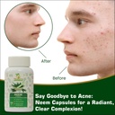 modern-ayurvedic-center-organic-neem-120-4.jpg