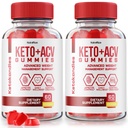 NutraRize (2 KetoKandies Keto+ACV iepakojums) Gumijas svara zudums, maksimālā stipruma papildinājums, Keto Kandys Atsauksmes (120 Gumijas)